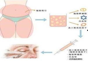 做假体鼻子视频,跟随视频学习专业技巧