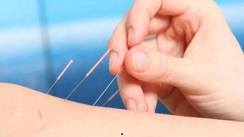 杨甲三针灸取视频教程